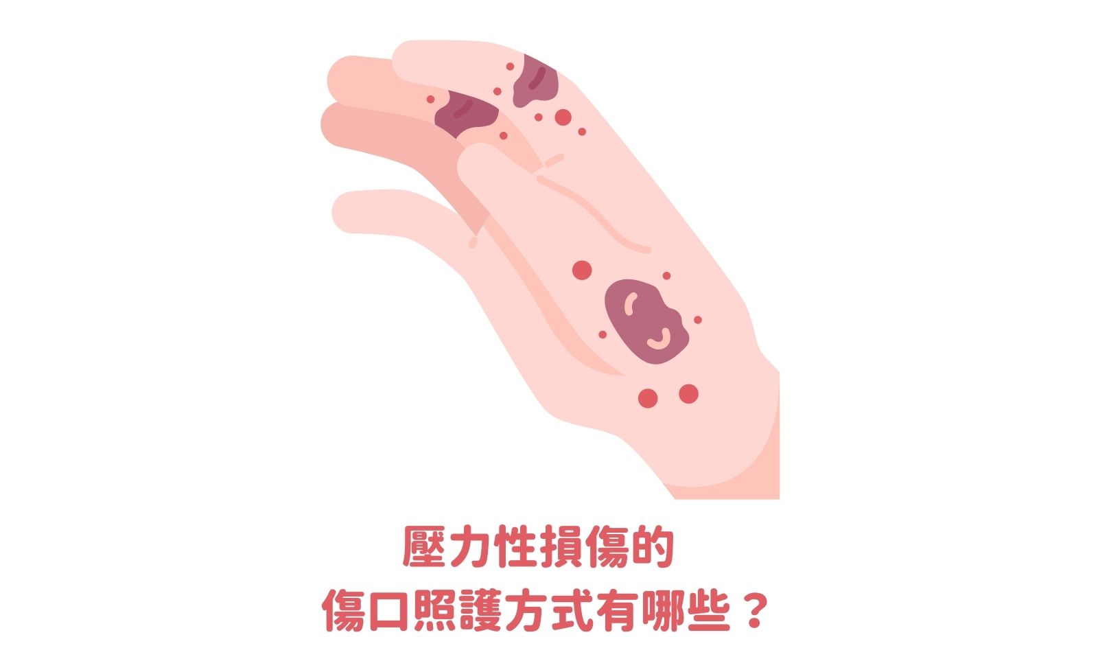 正確認識長輩的壓瘡治療與預防 - 顧名思醫